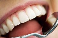 اجرای پویش سلامت دندان در فارس
