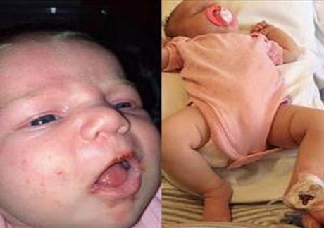 تولد یک نوزاد با ترکشی در سر! + عکس