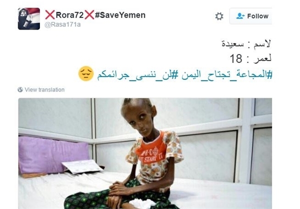مرگ میلیون‌ها یمنی در «جنگ فراموش شده»