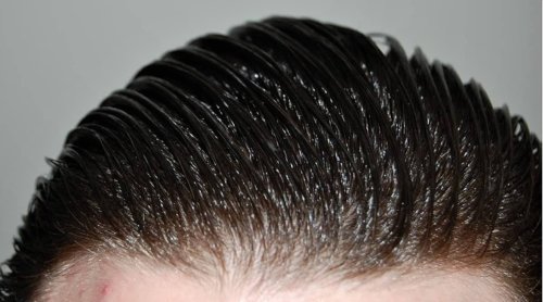 بهترین درمان‌های طبیعی برای موهای چرب