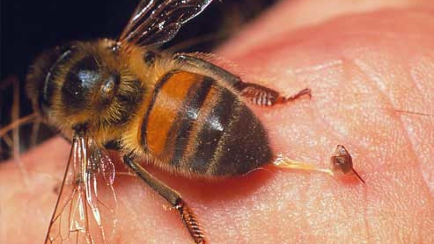 ۵ اقدام اورژانسی برای درمان گزیدگی توسط نیش زنبور
