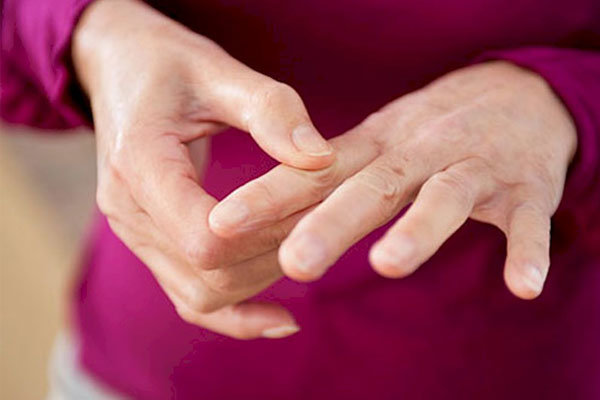 مصرف قرص های ضدبارداری خطر ابتلا به آرتروز را کاهش می دهد