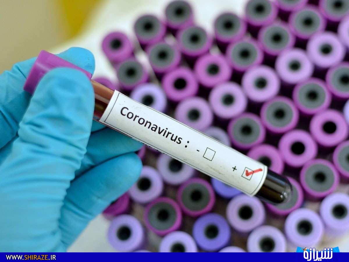 اولین آزمایشگاه تشخیص مولکولی کروناویروس در شیراز