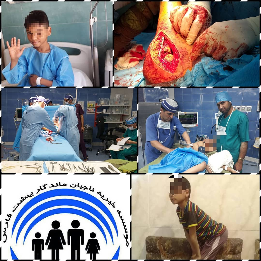 انجام عمل جراحی نادر برای کودک بی‌پناه اتباع خارجی