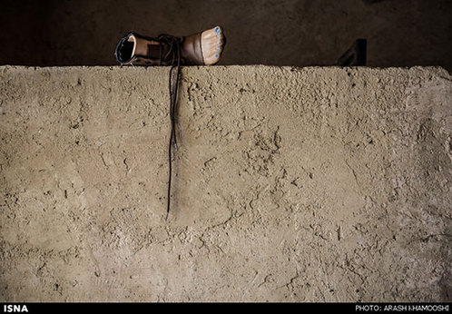 پای مصنوعی متعلق به گشین دختر ۱۰ ساله که پای چپش را حین بازی، ۲۶ مهر سال ۱۳۹۲ در پی انفجار مین از دست داده است. 