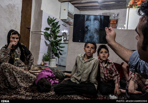 
یک پزشک داوطلب در حال نگاه کردن به تصویر رادیولوژی قفسه سینه‌ سینا است. بیشتر خانواده‌های حادثه‌دیده از مین، از وضعیت مالی مناسبی برخوردار نیستند و در کردستان نیز امکانات لازم برای درمان وجود ندارد.